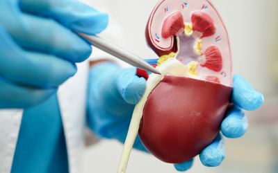 Understanding the Difference Between UTIs and Kidney Stones